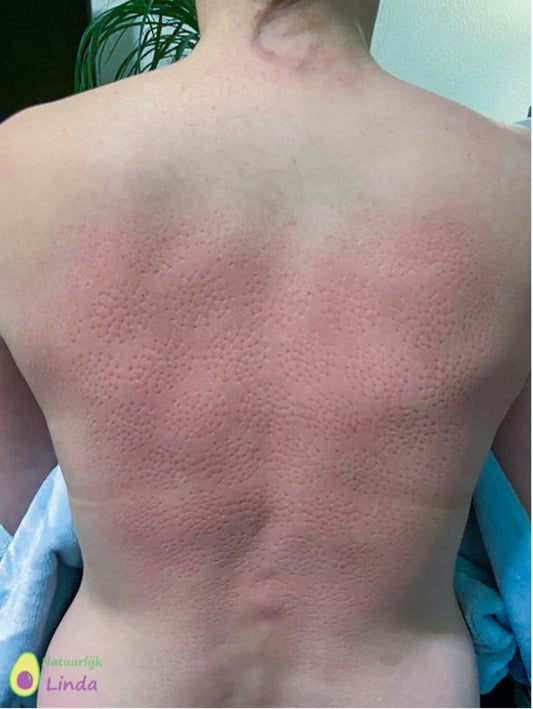 Ervaring Spijkermat van Natuurlijk Linda