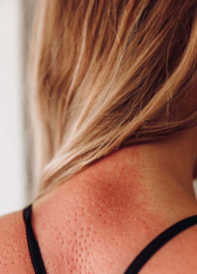 Reuma klachten in de nek